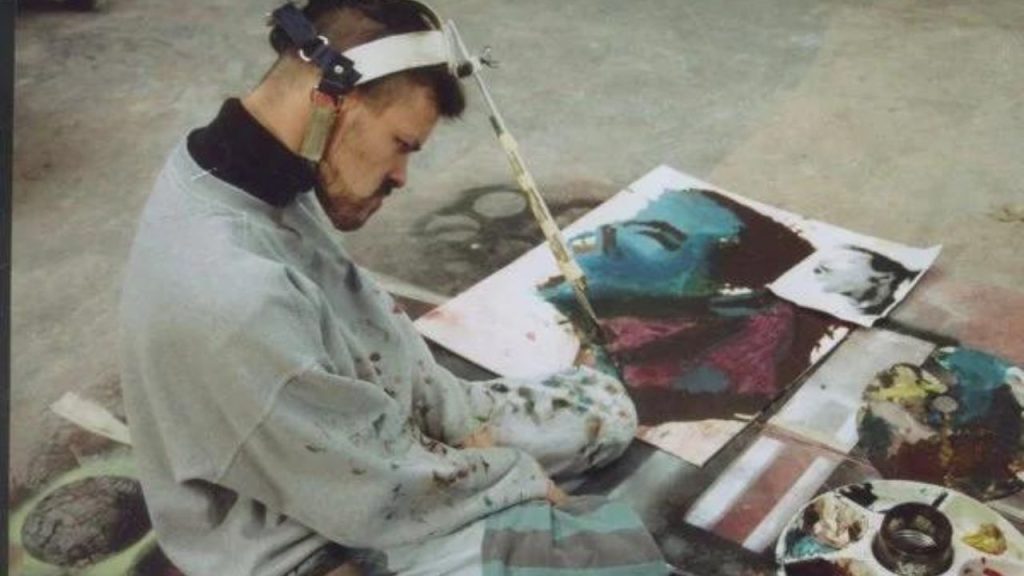 famous artist with cerebral palsy, Dan Keplinger