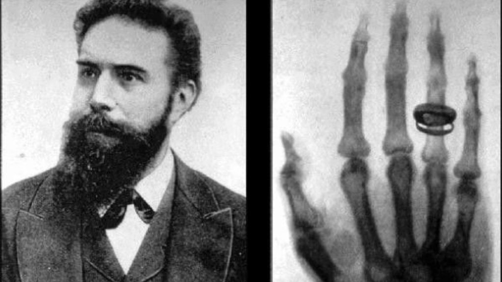 November Fun Fact- X-Rays Were Discovered